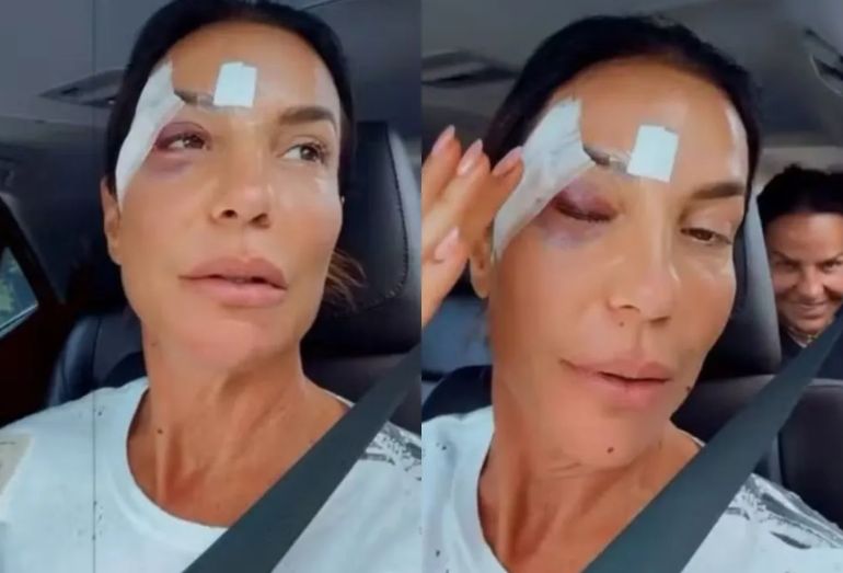 Ivete Sangalo recebe alta hospitalar e explica desmaio